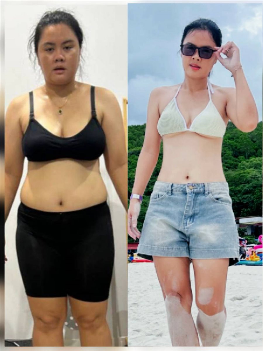 ภาพก่อนและหลังดูแลสุขภาพ รูปที่ 8